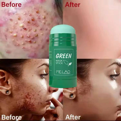 Masque Vert Éclat Visage
