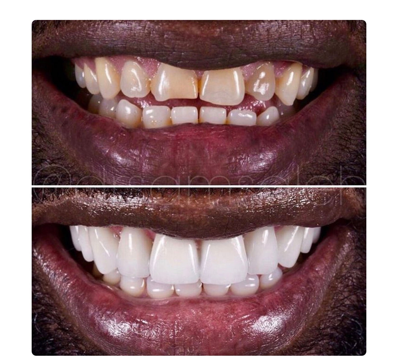 Finis les taches 🤩🦷