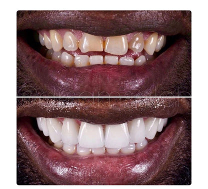 Finis les taches 🤩🦷